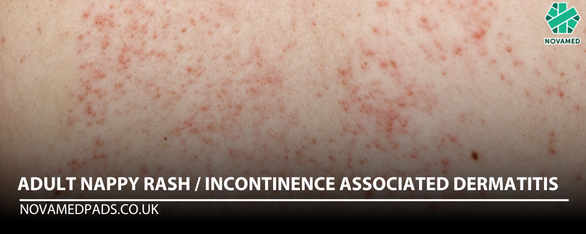 Adult Nappy Rash / Incontinence Associated Dermatitis - Novamed (Europe) ltd