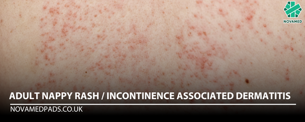 Pee Rash Adult Nappy Rash / Incontinence Associated Dermatitis