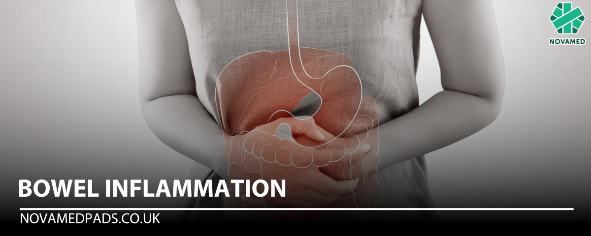 Bowel Inflammation - Novamed (Europe) ltd